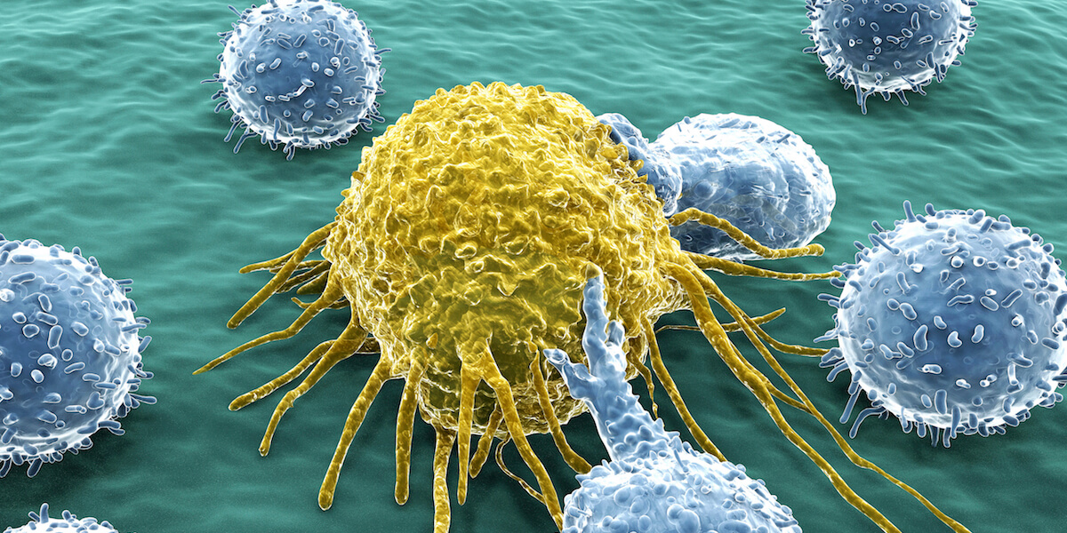 MedicalResearch.com: Breast Cancer Survival Strongly Depends On Where First Metastases Develops