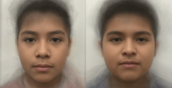 Combined faces of male study participants in each group. Left is control, right is CAH. (Photo/Courtesy of CHLA)