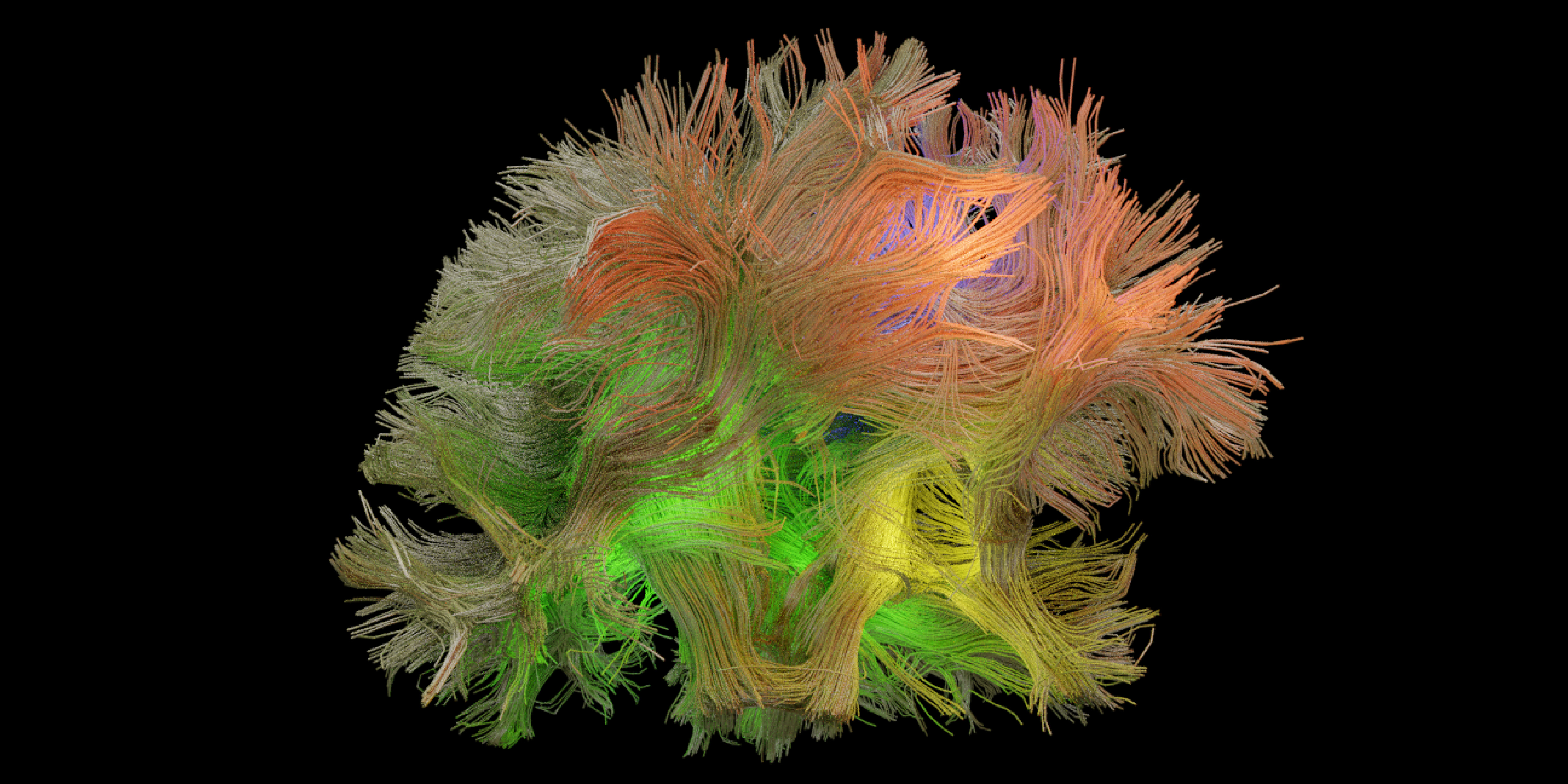 Brain with its fibers showing its immense complexity. The new machine learning method can isolate patterns in brain signals that relate to a specific behavior and decode the behavior much better than previous models/Credit: Omid Sani &amp; Maryam Shanechi, Shanechi Lab