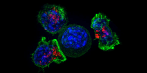 Killer T-cells surround a cancer cell. Image/NIH National Institute of Child Health and Human Development
