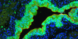 Immunohistochemistry image of mouse male bladder. Courtesy of Chad Vezina, GUDMAP Consortium.