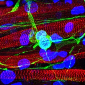 Motor neurons (green) are grown on top of skeletal muscle (red). The blue stains show the nuclei of the cells. Image: USC Laboratory for Living Systems Engineering