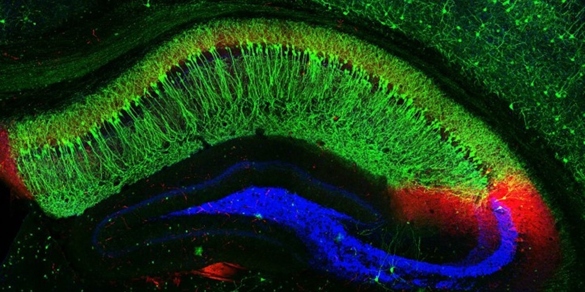 In Pursuit of a Realistic Model of the Hippocampus