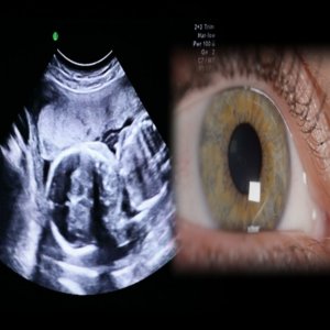 Ultrasound helps blind see