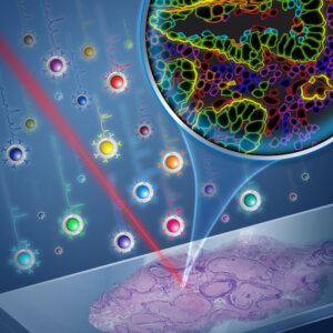 Cristina Zavaleta Nanoparticles for Imaging