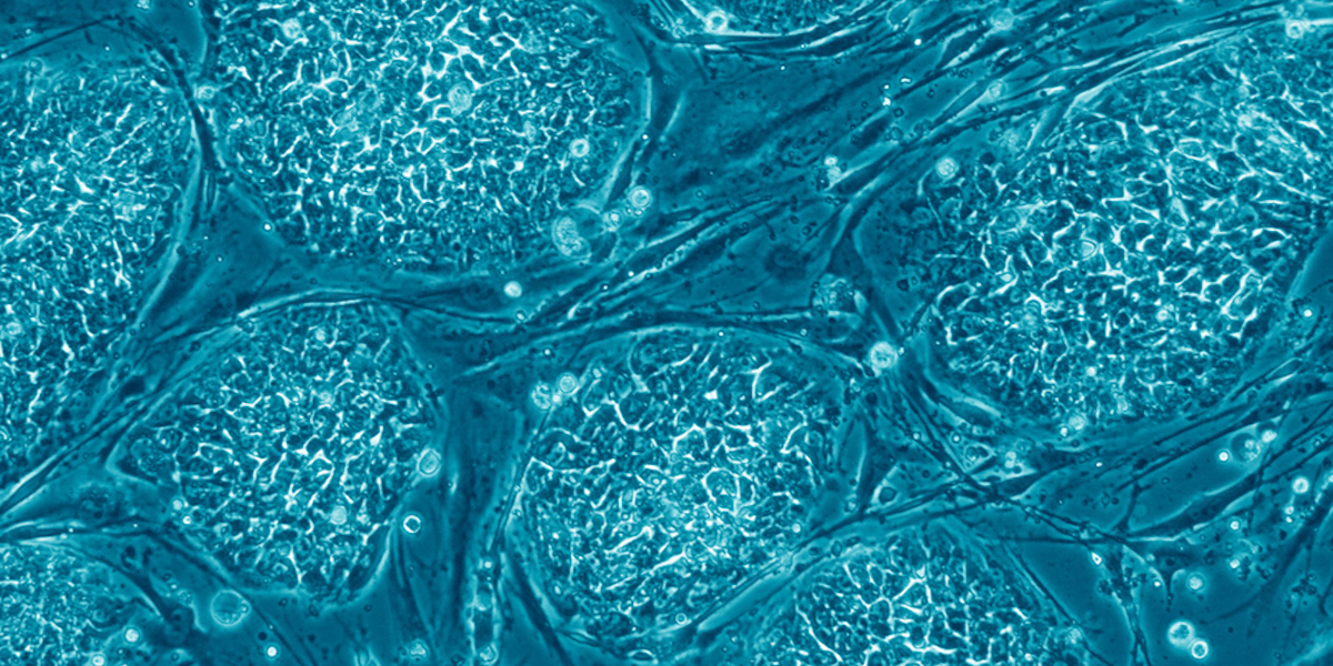 Human stem cells. Image/Wikimedia Commons