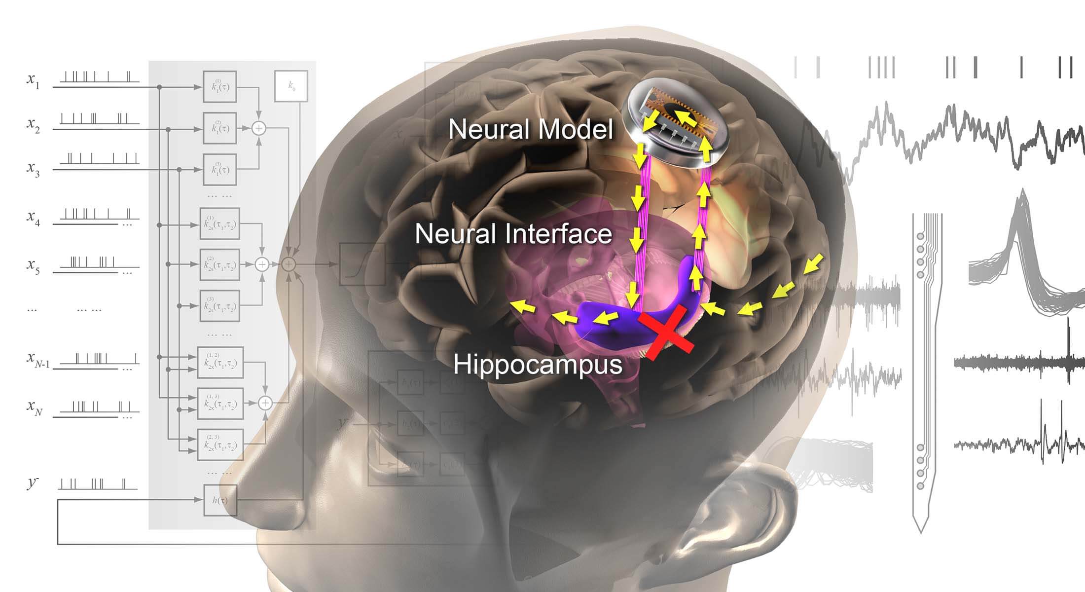 The prosthesis being developed by the USC Viterbi and Keck School of Medicine team stimulates the hippocampus, restoring lost memories. Image/USCNeural Modeling and Interface Lab