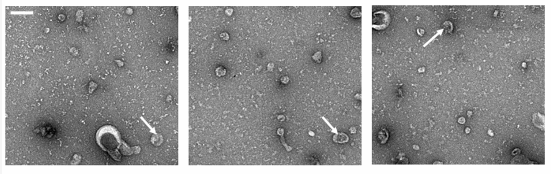 The Chung Lab's extracellular vesicles (EVs) — naturally-derived particles released from cells that have been genetically engineered to enhance their therapeutic benefits.