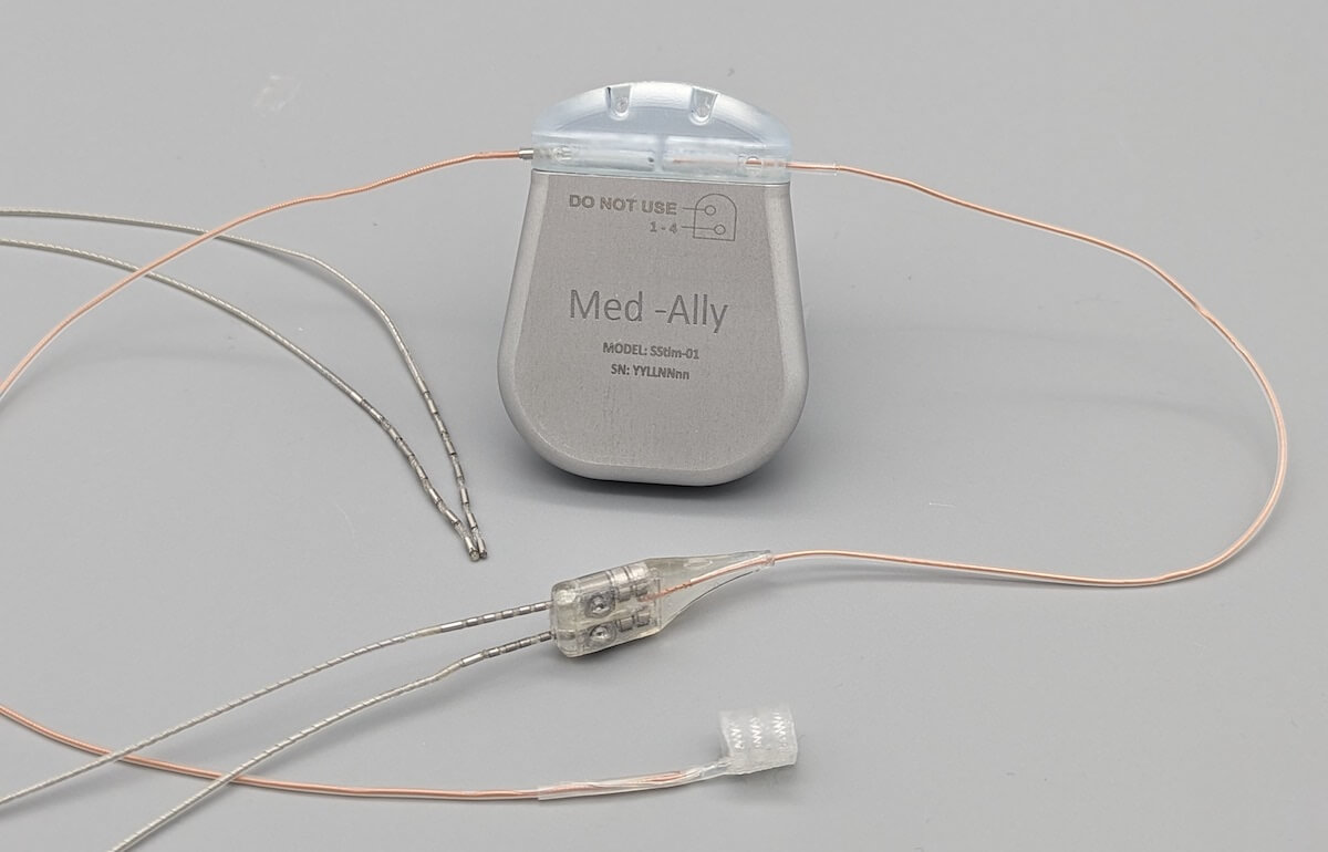 The OpenNerve Implantable Pulse Generator is an open-source medical device developed by USC's Center for Autonomic Nerve Recording and Stimulation Systems (CARSS). Image/CARSS